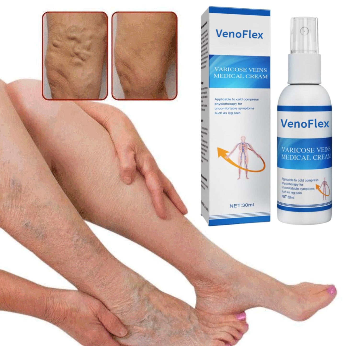 VenoFlex - Krema Za Proširene Vene