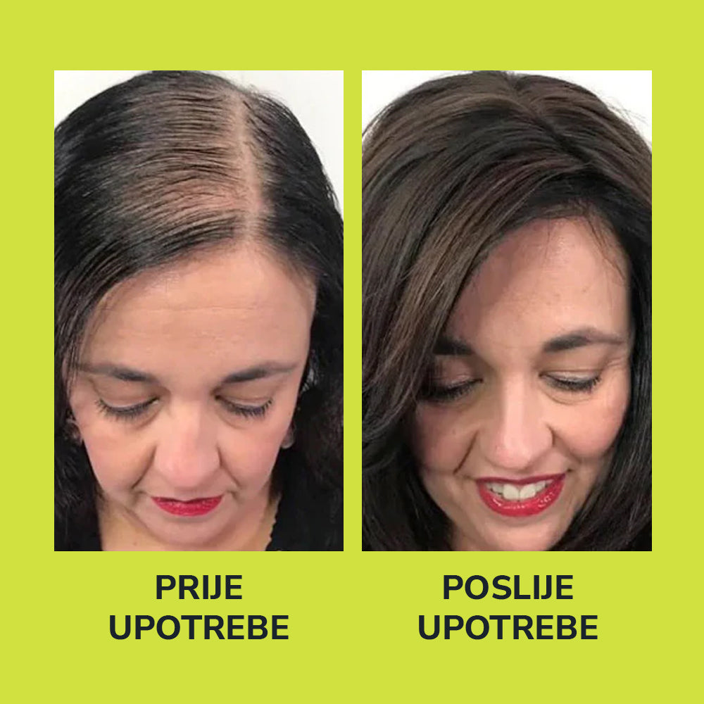 HerbaHair - Serum Za Rast Kose