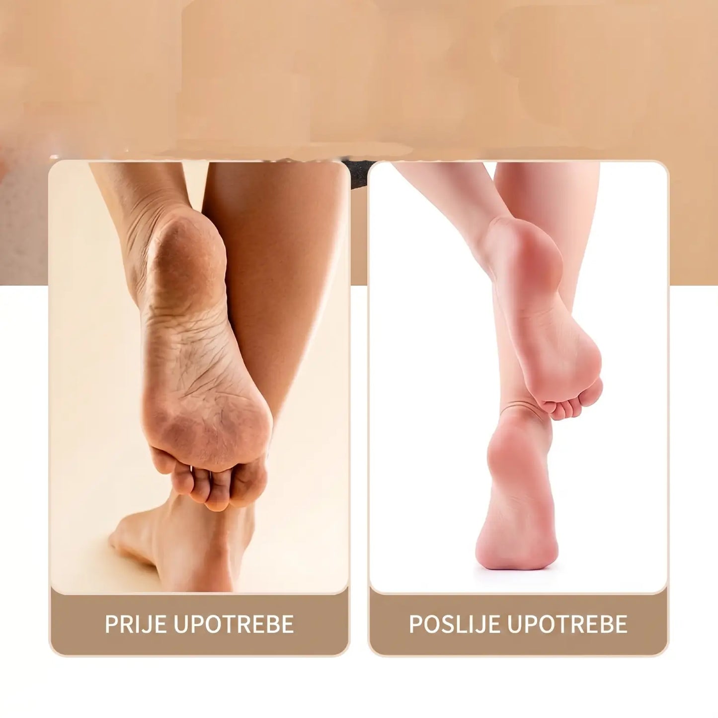 HeelFix - Inovativni uređaj za uklanjanje grube kože