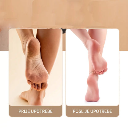 HeelFix - Inovativni uređaj za uklanjanje grube kože