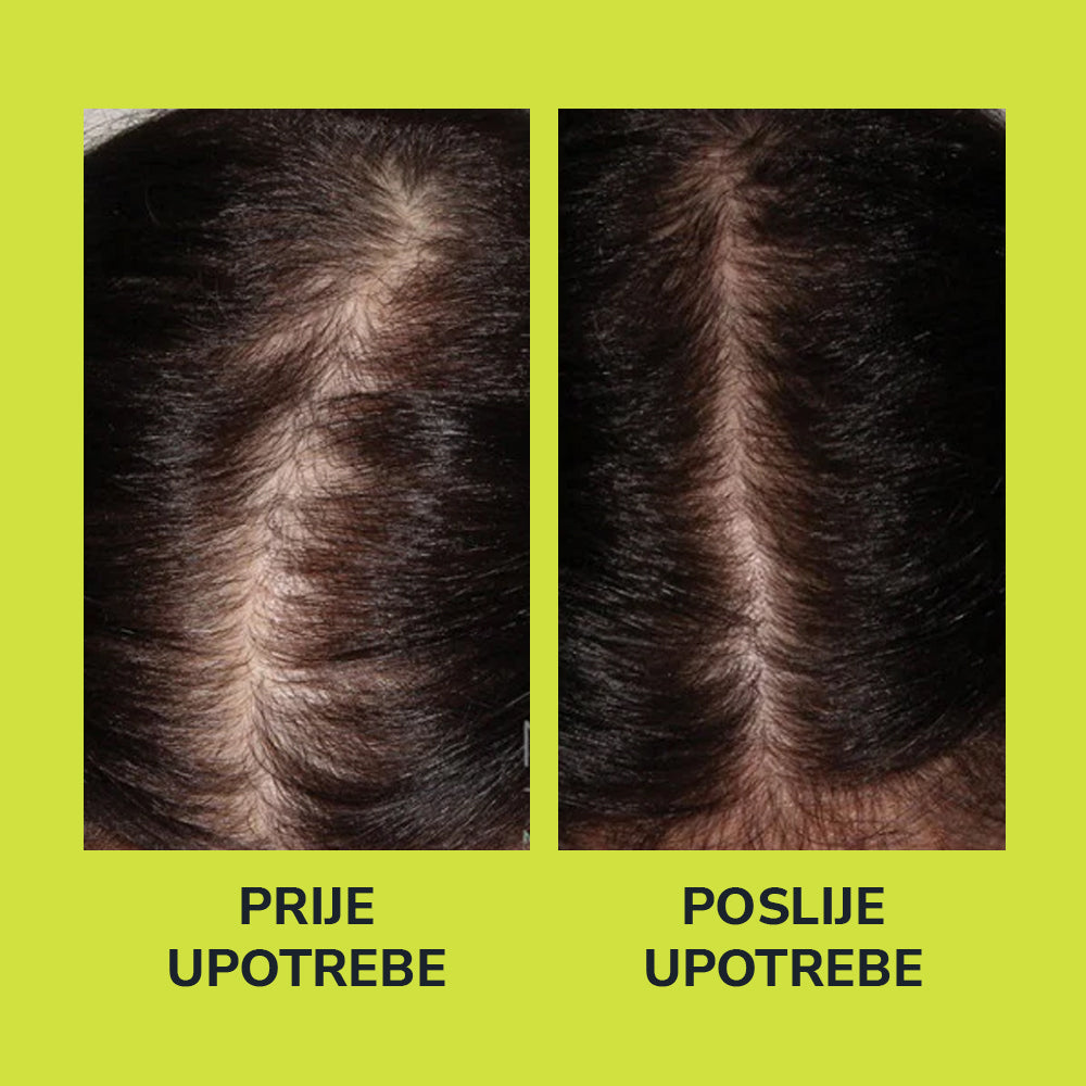 HerbaHair - Serum Za Rast Kose
