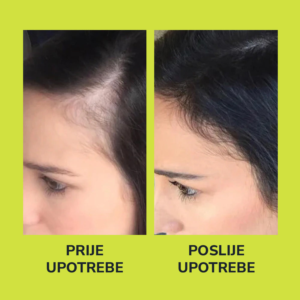 HerbaHair - Serum Za Rast Kose