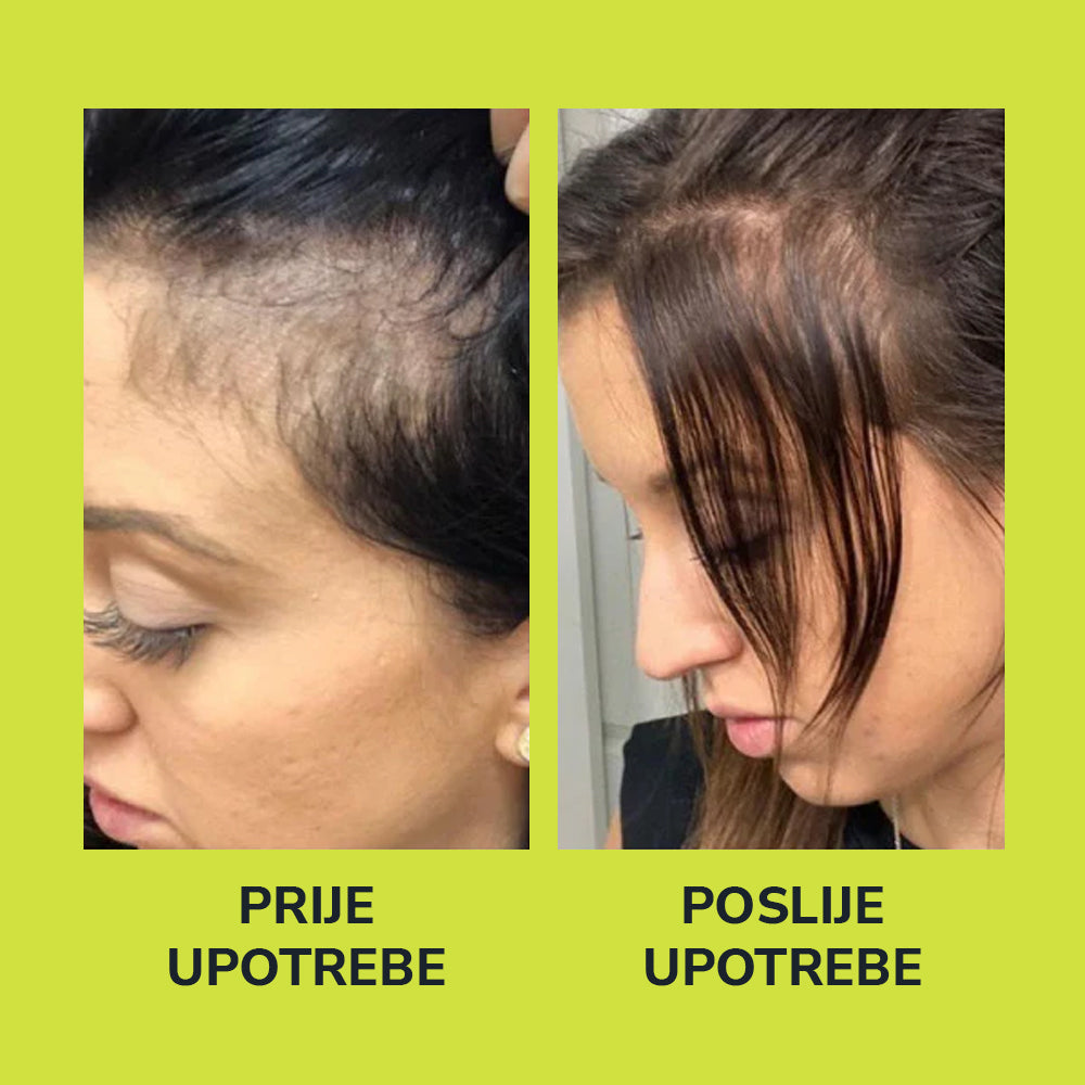 HerbaHair - Serum Za Rast Kose